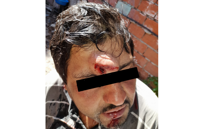 F. Varela: Hombre brutalmente golpeado por patota de manteros cobardes