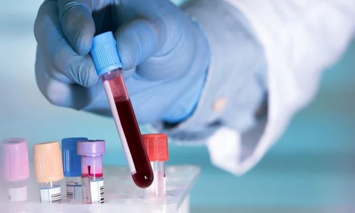 Un análisis de sangre podría detectar varios tipos de cáncer antes de que aparezcan síntomas
