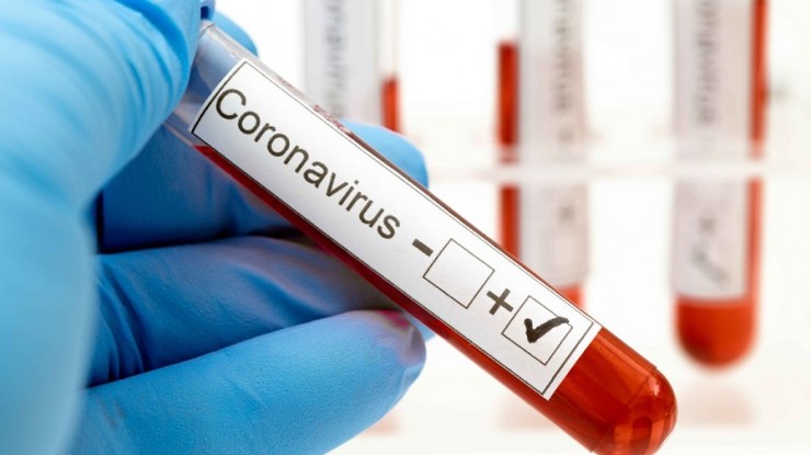 Coronavirus: confirmaron 12 nuevos casos en F. Varela