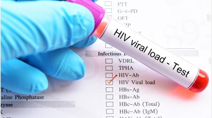 Testeo de VIH y VDRL en Las Malvinas