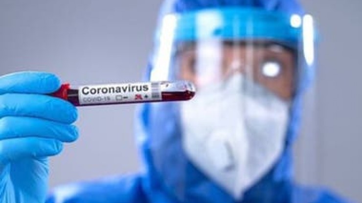 Coronavirus: 134 nuevos casos y 3 fallecimientos en Florencio Varela