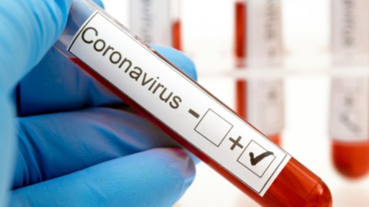 Coronavirus: 37 nuevos casos y un fallecimiento en Florencio Varela