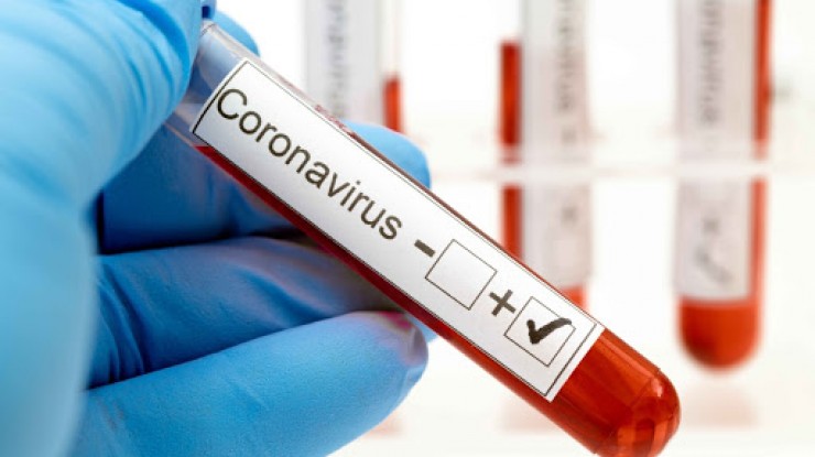 Coronavirus: confirmaron cuatro nuevos casos en F. Varela